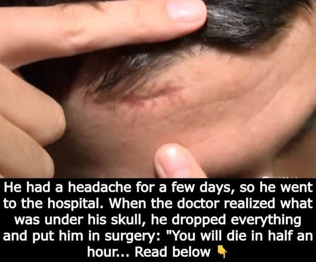 He visited the hospital after experiencing a headache for several days.