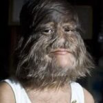 World’s ‘Hairiest Girl’ Shaves It All Off After Meeting Her Soulmate, Here’s How She Looks After