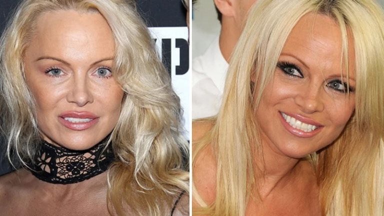 Pamela Anderson is now 55 years old and choosing to reveal her ‘natural’ face