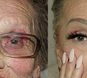 The Magical Transformation of an 80-Year-Old Woman: Before and After Photos