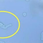 I Always Wondered Why I Had These Floating In My Eye..Then A Doctor Told Me What They Are