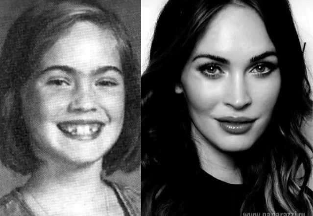 This baby with rabbit teeth and a monobrow grew up to be one of the best actresses in Hollywood… Check out how she looks now!