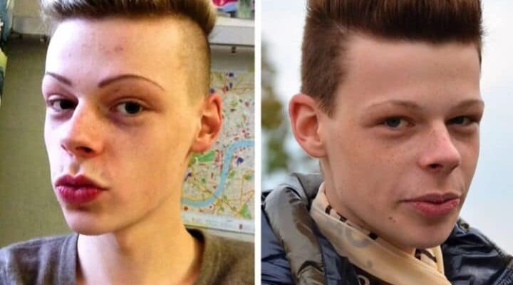 Meet Patrick Mast, Who Spent $73,000 To Look Like A Doll, But Wait Until You See The End Results