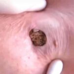 SUDDEN UNEXPLAINED SYMPTOMS!!!