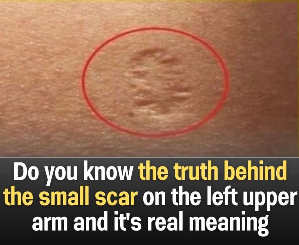 True Meaning Behind the Tiny Scar on Your Upper Left Arm!”