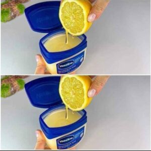 Just Mix Vaseline with Lemon and you will be shocked! Method in the first comment