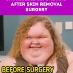 “Proud of You,” 1000-lb Sisters Star’s Incredible Before and After Skin Removal Surgery