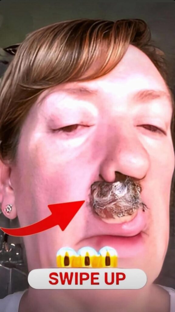 Body Acne: 4 Tips To Get Rid Of Them